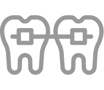 Clear Aligners
